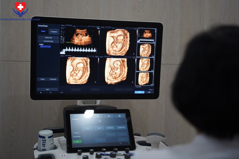 Siêu âm thai giúp theo dõi quá trình phát triển của thai nhi